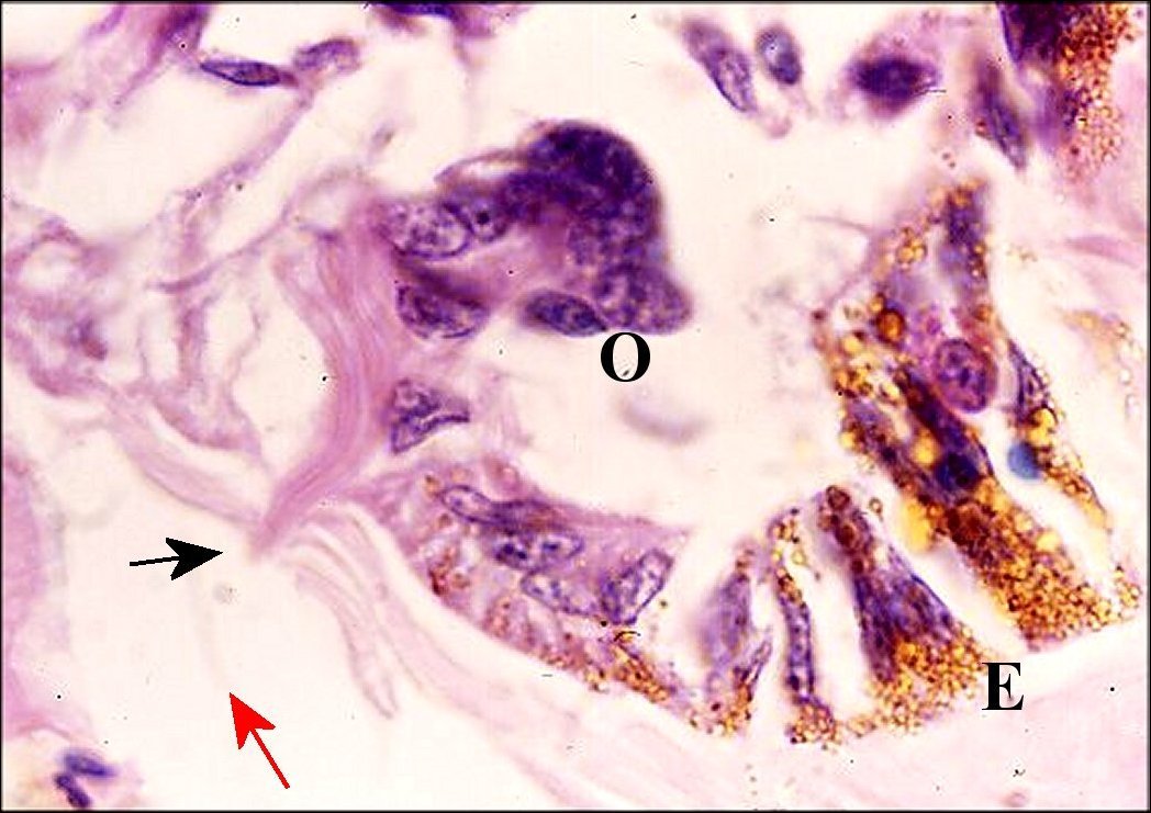 Cheiracanthium punctorium 12